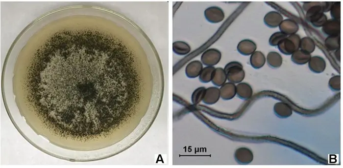 A: A petri dish with a fungal culture showing dense, dark mold spore growth in the center on a light beige medium. B: A microscopic view of round fungal spores connected by thin filamentous hyphae, with a scale bar indicating 15 µm — perfect for rigorous investigation and testing.