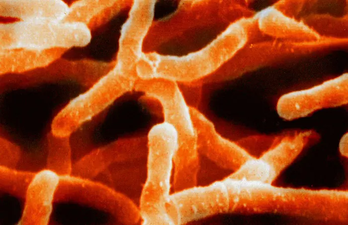 A close-up microscopic inspection reveals bacterial cells in vibrant orange, their elongated rod-like shapes forming an interconnected, branching pattern against a dark background.